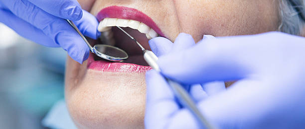 Best Emergency Dentist for Knocked-Out Tooth in Jones Creek, TX